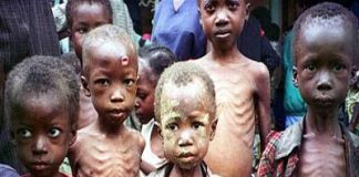Malnourished children.